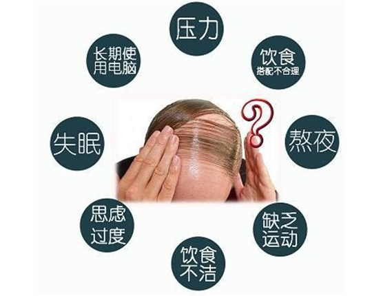 脱发怎么治疗更有效果-海口脱发医院